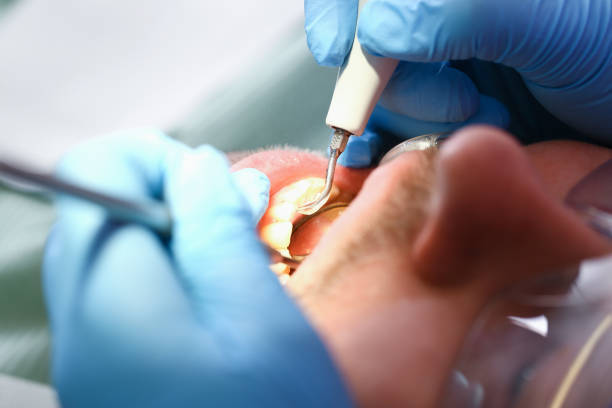 Best Weekend Emergency Dental Services in Morgan, UT