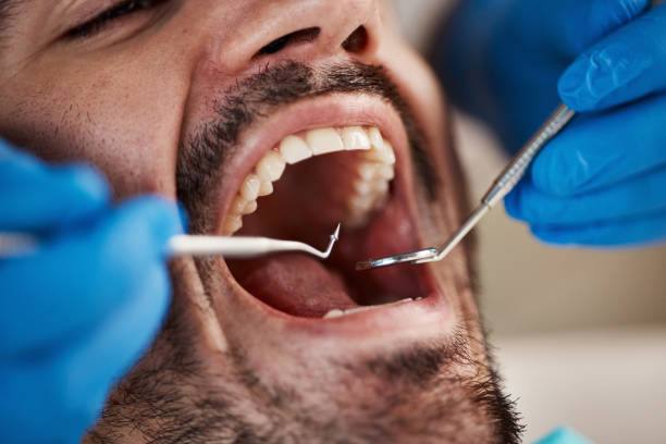 Best Emergency Dental Care for Sports Injuries in Morgan, UT