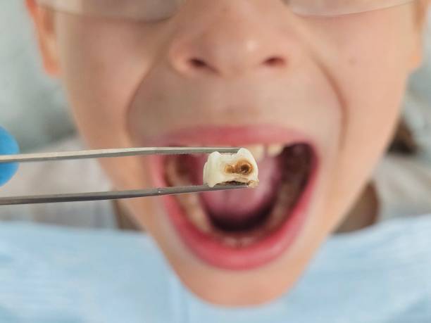 Best Emergency Pediatric Dental Care in Morgan, UT