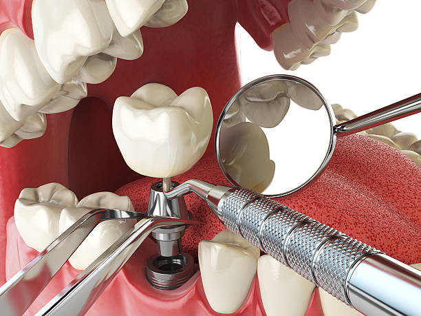 Best Emergency Dental Care for Sports Injuries in Morgan, UT