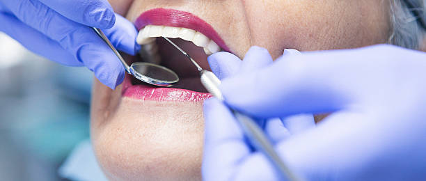 Best Emergency Care for Gum Disease in Morgan, UT